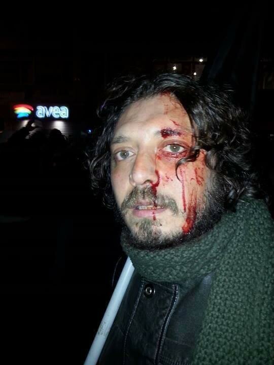 Kadıköy- Bir kişinin başına gaz kapsülü gelmesi sonucu yaralandı